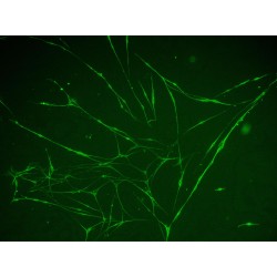 Rat Trigeminal Ganglion Neuron Cells (TGN)