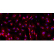 Immunofluorescence identification of CD44 (200X).