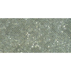 Rat Pericardial Mesothelial Cells (PeMC)