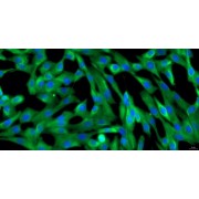 Immunofluorescence identification of Vimentin (400X).