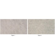 Morphology of Cat BMMC (x200 lens). Figure 1: Low Density, Figure 2: High Density.