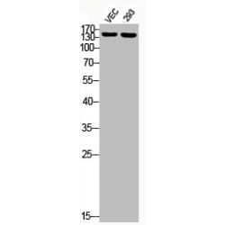 Insulin Receptor Substrate 1 Phospho-Ser307 (IRS1 pS307) Antibody