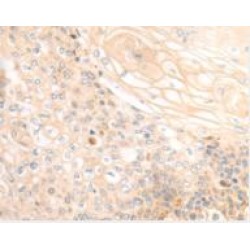 Melanoma Antigen Preferentially Expressed In Tumors (PRAME) Antibody (FITC)