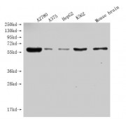 WB analysis of A2780, A375, HepG2 and K562 whole cell lysates and mouse brain tissue, using PRAME antibody (1/1000 dilution) and goat anti-rabbit IgG secondary antibody (1/50000 dilution). Predicted band size: 58 kDa, observed band size: 58 kDa.