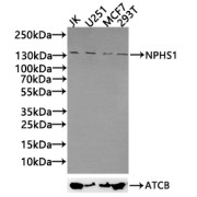WB analysis of JK-1, U251, MCF7, 293T whole cell lysates (30 µg) using Nephrin (NPHS1) antibody (1/1000 dilution) and a Goat anti-Rabbit IgG antibody (1/50000 dilution). Calculated MW: 131 kDa, 135 kDa. Observed MW: 135 kDa.