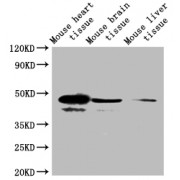 WB analysis of Mouse heart, brain and liver tissue, using SELENOP antibody (1/2000 dilution) and Goat Anti-Rabbit IgG (1/50000 dilution). Predicted band size: 43 kDa. Observed band size: 40 kDa, 43 kDa.