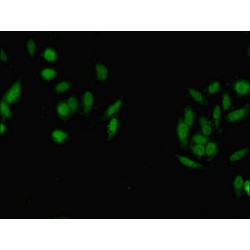 Set1/Ash2 Histone Methyltransferase Complex Subunit ASH2 (ASH2L) Antibody