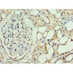 Set1/Ash2 Histone Methyltransferase Complex Subunit ASH2 (ASH2L) Antibody