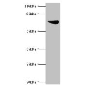 WB analysis of K562 whole cell lysates, using ASH2L antibody.