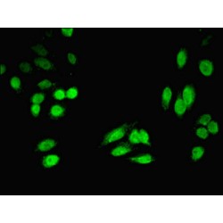 4-Hydroxyphenylpyruvate Dioxygenase (HPD) Antibody