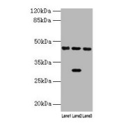 WB analysis of Mouse kidney tissue (lane 1), Mouse liver tissue (lane 2) and HepG2 whole cell (lane 3) lysates using 4-Hydroxyphenylpyruvate Dioxygenase (HPD) antibody (4.5 μg/ml) and a Goat anti-Rabbit IgG antibody (1/10000 dilution). Calculated MW: 41 kDa, 45 kDa. Observed MW: 45 kDa.