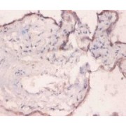 Endoplasmic Reticulum Chaperone BiP (HSPA5) Antibody