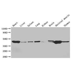 Actin, Alpha Skeletal Muscle (ACTA1) Antibody