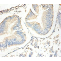 Antileukoproteinase (SLPI) Antibody