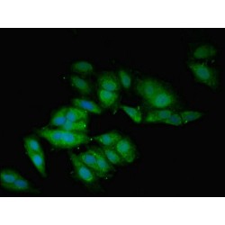 Bone Morphogenetic Protein 2 (BMP2) Antibody