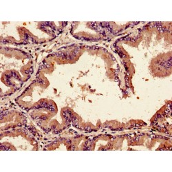Bone Morphogenetic Protein 2 (BMP2) Antibody