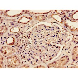 Bone Morphogenetic Protein 2 (BMP2) Antibody