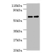 WB analysis of (1) Mouse Liver Tissue, and (2) Rat Liver Tissue, using CES1C antibody (2 µg/ml). Predicted band size: 62 kDa, Observed band size: 62 kDa.
