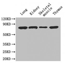Carboxylesterase 1C (CES1C) Antibody
