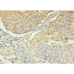 Caspase 3 (CASP3) Antibody