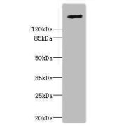 Western blot analysis of Complement C3 antibody (20 µg/ml) with Goat anti-Rabbit polyclonal antibody (1/10000 dilution). Predicted band size: 187.61 kDa, Observed band size: 186 kDa.