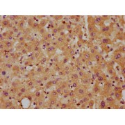 IHC-P analysis of human liver tissue, using DLL3 antibody (1/700 dilution). After dewaxing and hydration, antigen retrieval was mediated by high pressure in a citrate buffer (pH 6.0). Section was blocked with 10% normal goat serum for 30 min at room temperature. The primary antibody (1% BSA) was then incubated at 4°C overnight. The primary is detected by a biotin-conjugated secondary antibody and visualized using an HRP-conjugated SP system.