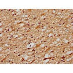 Delta Like Protein 3 (DLL3) Antibody