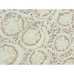 Fatty Acid Binding Protein 1, Liver (FABP1) Antibody