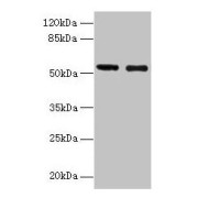Western blot analysis of Mouse heart tissue (Lane 1) and 293T whole cell lysate using Glucagon-Like Peptide 1 Receptor Antibody (12 µg/ml) and Goat Anti-Rabbit IgG (1/10000 dilution).