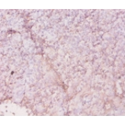 HLA Class II Histocompatibility Antigen, DR Alpha Chain (HLA-DRA) Antibody