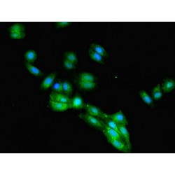 Fc Fragment Of IgG Receptor Transporter Alpha (FCGRT) Antibody