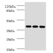 WB analysis of (1) HepG2 whole cell lysates, (2) Mouse Liver Tissue, and (3) A549 whole cell lysates, using FCGRT Antibody (2 µg/ml). Predicted band size: 40 kDa. Observed band size: 40 kDa.