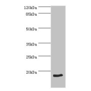 Western blot analysis of HeLa whole cell lysate, using NT-ProBNP antibody (2 µg/ml).