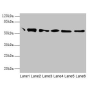WB analysis of (1) Mouse Brain Tissue, (2) Colo320 whole cell lysate, (3) HepG2 whole cell lysate, (4) 293T whole cell lysate, (5) Hela whole cell lysate, and (6) MCF-7 whole cell lysate, using P4HB antibody (1.8 µg/ml) and goat anti-rabbit IgG secondary antibody (1/10000 dilution). Predicted band size: 58 kDa, observed band size: 58 kDa.
