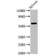 WB analysis of rat spleen tissue, using RBMY1A1 antibody (2.5 µg/ml).