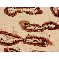 Serum Amyloid A Protein (SAA1) Antibody
