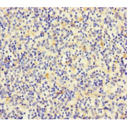Talin 2 (TLN2) Antibody