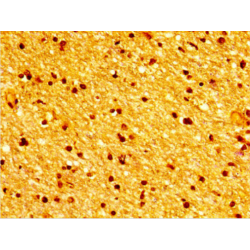 Tubulin Beta 3 (TUBB3) Antibody