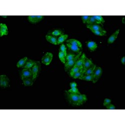 Zinc Finger Protein GLI1 (GLI1) Antibody