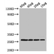 Western blot analysis of Rosseta bacteria lysate, using rpsB antibody (2.5 µg/ml) and Goat Anti-Rabbit IgG (1/50000 dilution).