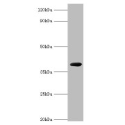 Western blot analysis of recombinant Carboxypeptidase G2 (0.5 µg) using Carboxypeptidase G2 antibody (2 µg/ml). Predicted band size: 44 kDa, observed band size: 44 kDa.