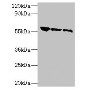 WB analysis of rabies virus antigen at (1) 1/2, (2) 1/10, and (3) 1/20 dilutions, using Rabies virus Glycoprotein G Antibody (1/500 dilution) and goat anti-rabbit IgG (1/10000 dilution). Predicted band size: 55 kDa, Observed band size: 55 kDa.