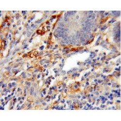Calretinin (CALB2) Antibody