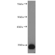 Calretinin (CALB2) Antibody