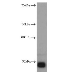 Calretinin (CALB2) Antibody