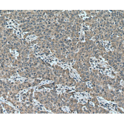 Cell Cycle Progression Protein 1 (CCPG1) Antibody