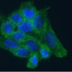 Cyclin-Dependent Kinase Inhibitor 2A (CDKN2A) Antibody