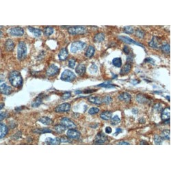 Cyclin-Dependent Kinase Inhibitor 2A (CDKN2A) Antibody