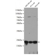 Western blot analysis of various cell lysates subjected to SDS-PAGE, using CDKN2A antibody (1/600 dilution, incubated at room temperature for 1.5 h).