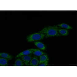 Extracellular Matrix Protein 1 (ECM1) Antibody